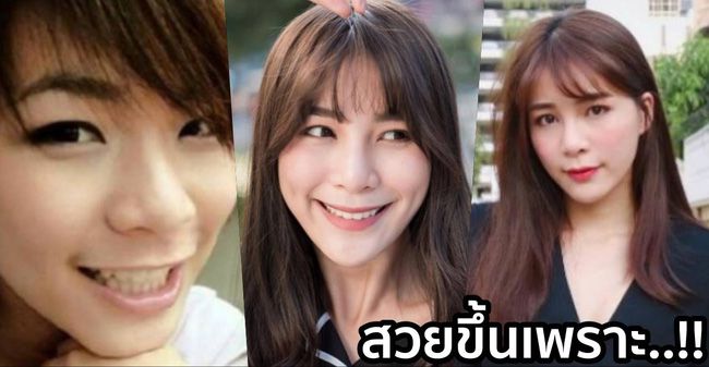 Mario Maurer lên tiếng về chuyện thẩm mỹ của "bạn gái tin đồn" (3) Mario Maurer lên tiếng về chuyện thẩm mỹ của "bạn gái tin đồn" (3)
